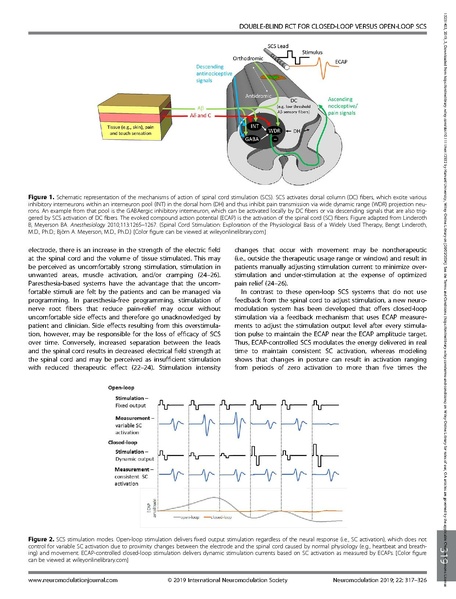 File:EVOKE Study Closed Loop SCS.pdf