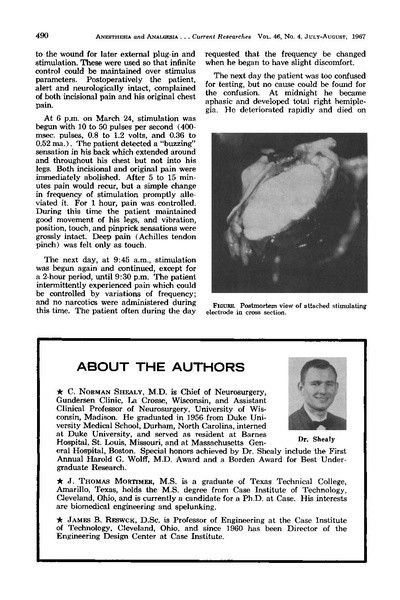 File:Electrical Inhibition of Pain by Stimulation of Dorsal Columns.pdf