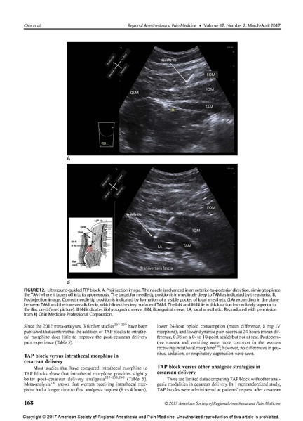 File:Essentials of Our Current Understanding .Abdominal Wall.pdf