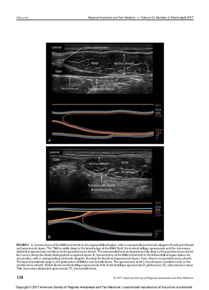 File:Essentials of Our Current Understanding .Abdominal Wall.pdf