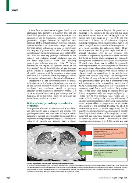 File:Goligher 2016 Lancet - Guides to ventilation.pdf