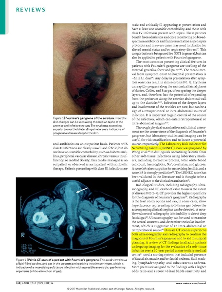File:Haggedorn 2017 Nature Urology - Fournier's gangrene.pdf
