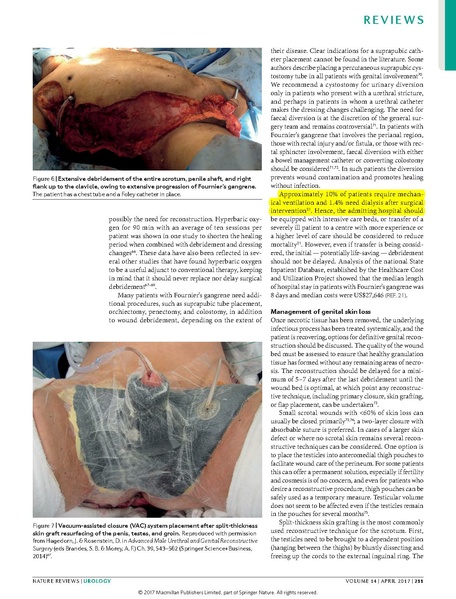 File:Haggedorn 2017 Nature Urology - Fournier's gangrene.pdf