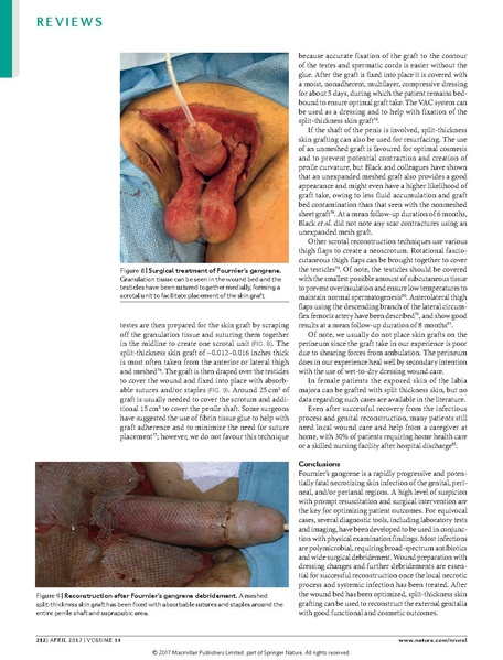 File:Haggedorn 2017 Nature Urology - Fournier's gangrene.pdf