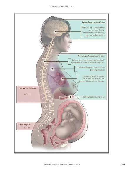 File:Hawkins NEJM 2010.pdf