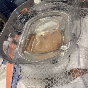 Hisotripsy set up.jpg