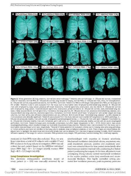 File:Hoftman Internl Anes Research Society 2017 - FVC for TV-UCLA.pdf