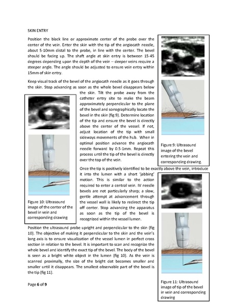 File:Hyder - Ultrasound guided IV access revised (1) (1).pdf