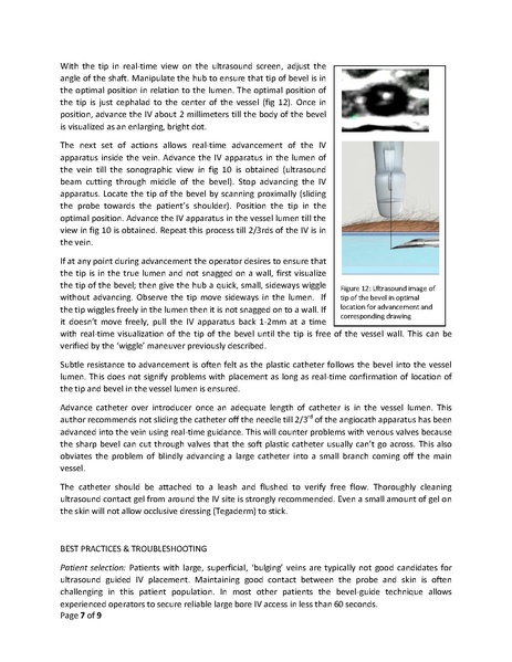 File:Hyder - Ultrasound guided IV access revised (1) (1).pdf