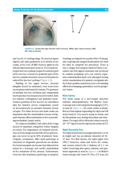 File:Introduction to Flexible Bronchoscopy.pdf