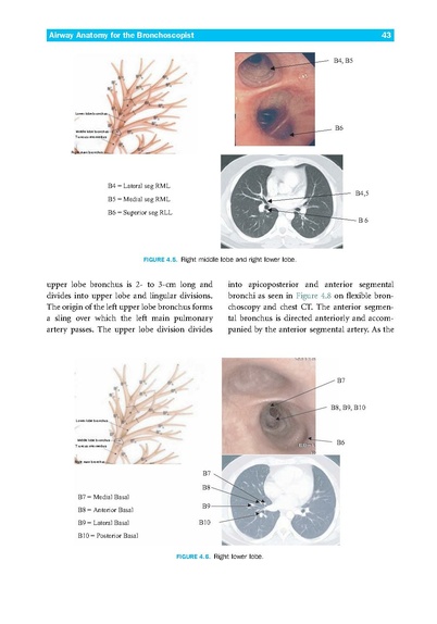 File:Introduction to Flexible Bronchoscopy.pdf