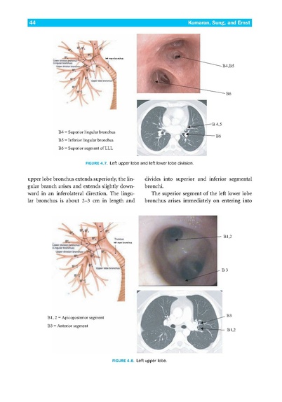 File:Introduction to Flexible Bronchoscopy.pdf