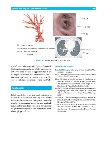 File:Introduction to Flexible Bronchoscopy.pdf