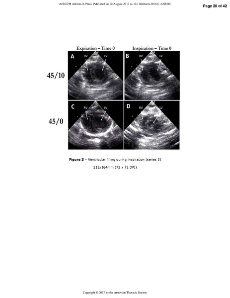 File:Katira AJRCCM 2017 - Heart Lung Interactions in VILI.pdf