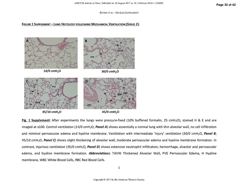 File:Katira AJRCCM 2017 - Heart Lung Interactions in VILI.pdf