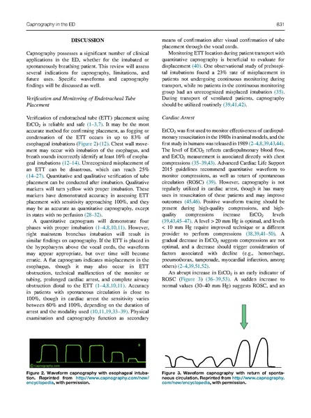 File:Long Journal of Emerg Med 2017 - ET carbon dioxide uses.pdf