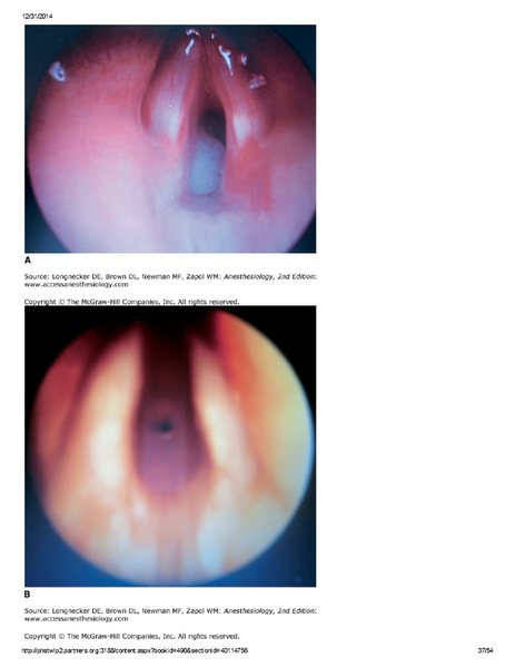 File:Longnecker Chapter 67 ENT Surgery Bil Ragan.pdf