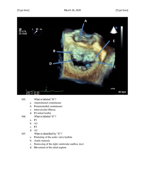 File:MGH Cardiac Anesthesia ECHO Questions (March 26, 2020).pdf