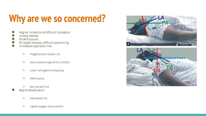 File:Obstetric Anesthesia CA1 Lecture 05Feb21.pdf