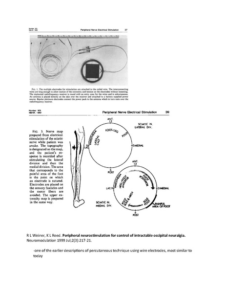 File:Overview of Peripheral Nerve Stimulation.pdf