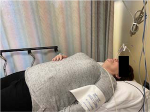 Patient A receiving the SPGB.png