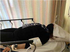 Patient B receiving the SPGB.png