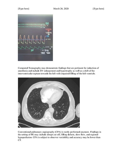 File:Pulmonary Thromboendarterectomy (March 26, 2020).pdf