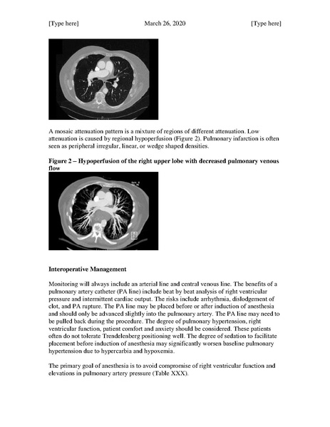 File:Pulmonary Thromboendarterectomy (March 26, 2020).pdf