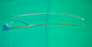 Pulmonary Vein Vent Catheter.png