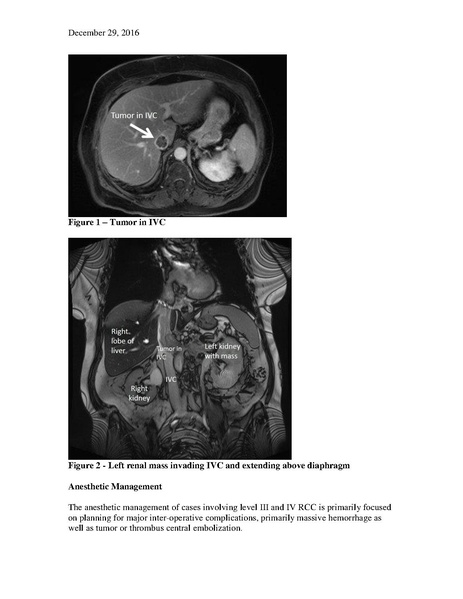File:Renal Cell Carcinoma Management (December 6, 2016).pdf