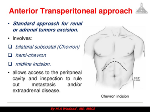 Renal Incision 1.png