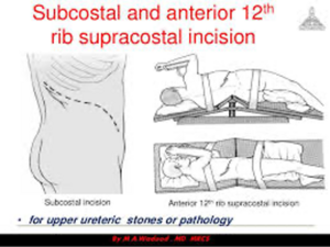 Renal Incision 2.png