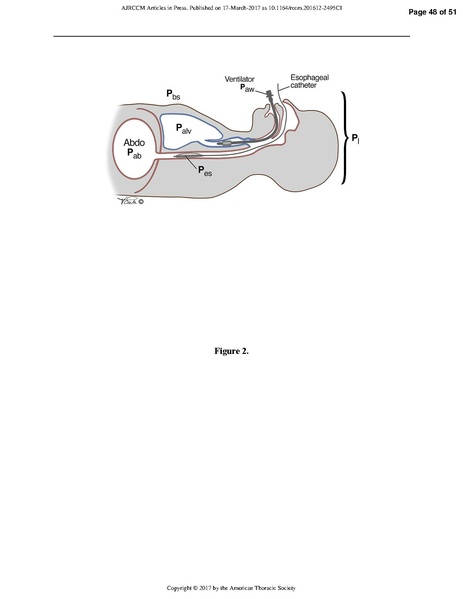 File:Respiratory Mechanics in ARDS.pdf