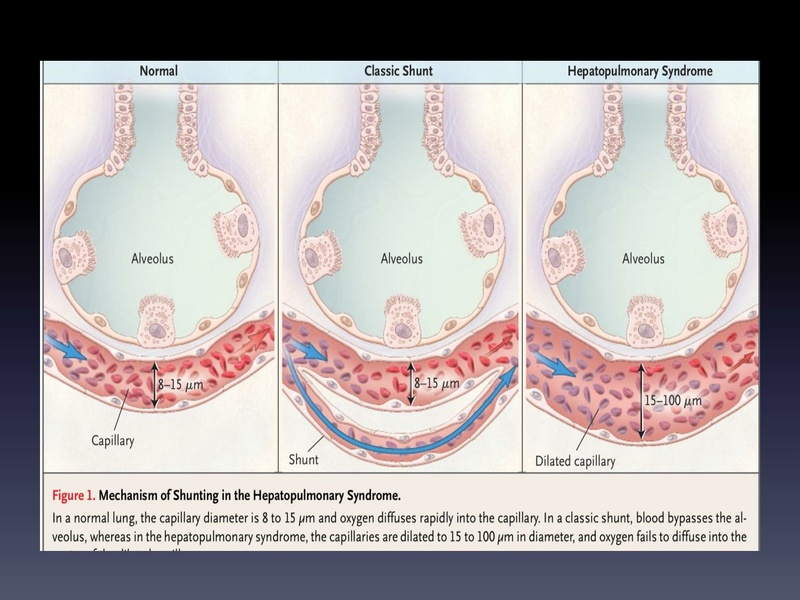 File:Respiratory Rounds 2017-03-11.pdf