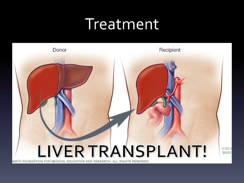 File:Respiratory Rounds 2017-03-11.pdf