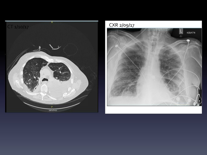 File:Respiratory Rounds 2017-03-11.pdf