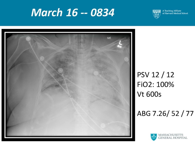 File:Respiratory Rounds 2017-04-21.pdf