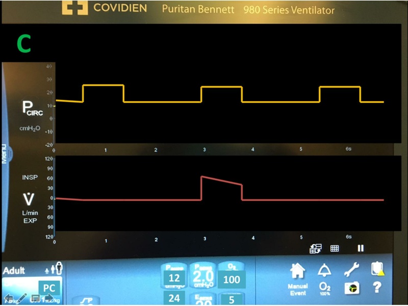 File:Respiratory Rounds 2017-04-21.pdf