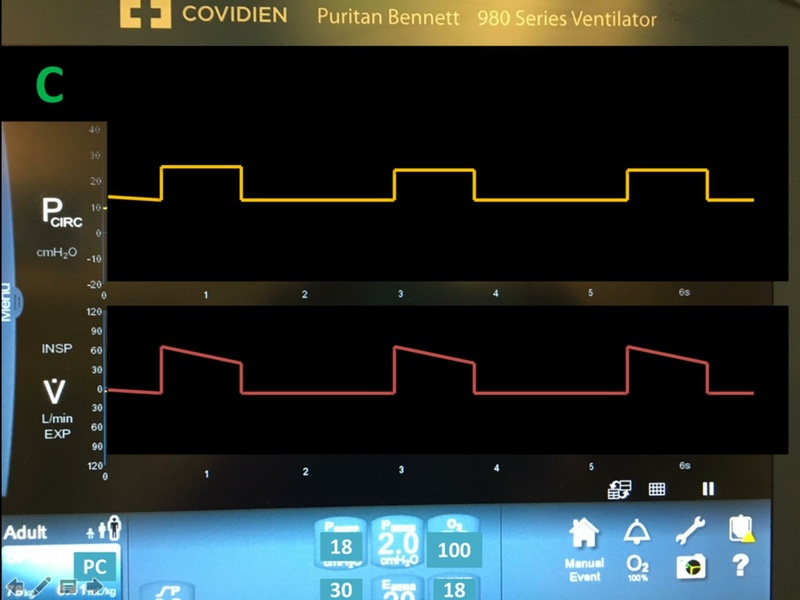 File:Respiratory Rounds 2017-04-21.pdf