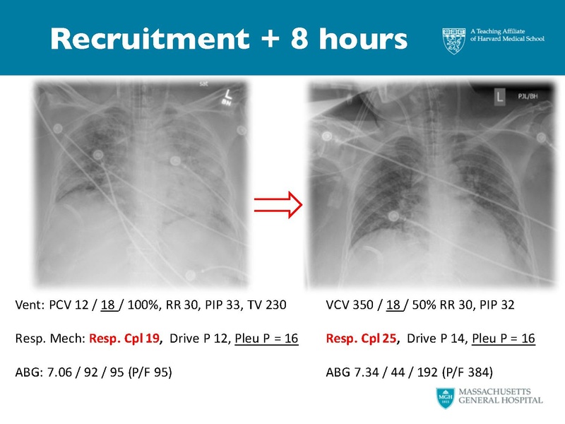 File:Respiratory Rounds 2017-04-21.pdf