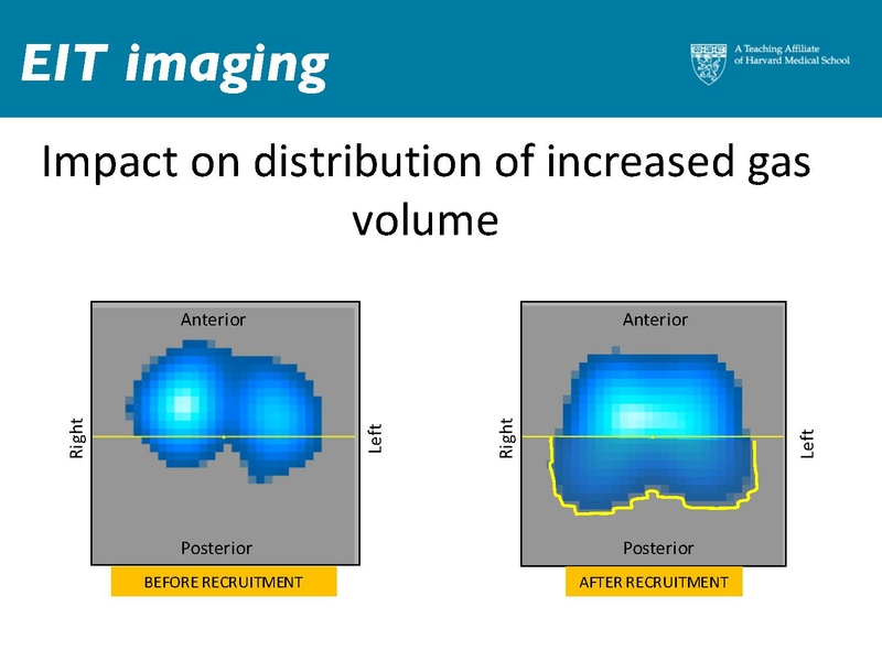 File:Respiratory Rounds 2017-04-21.pdf