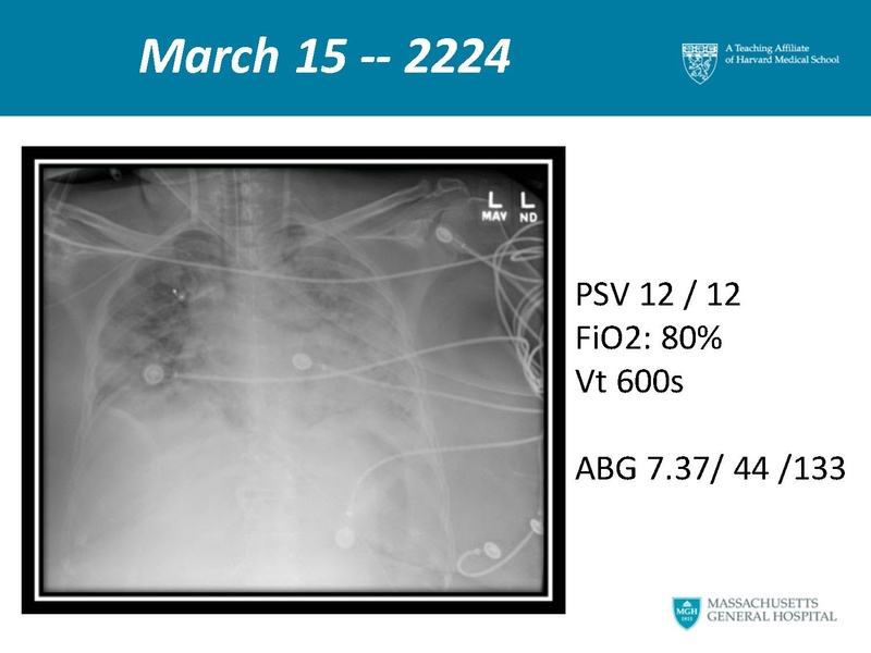 File:Respiratory Rounds 2017-04-21.pdf