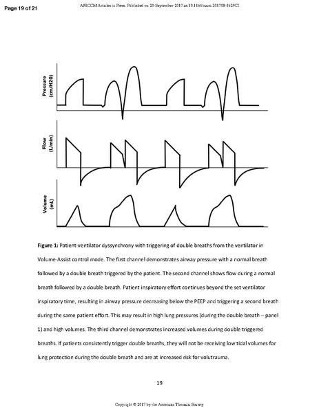 File:Sahetya ATS 2017 - Tidal volume in ARDS.pdf