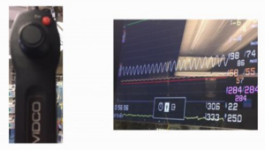 Setting up P5-P6 on Vidco.png