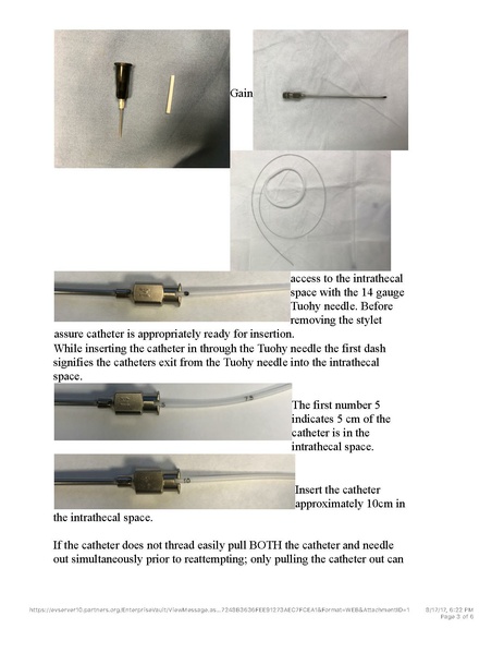 File:Spinal Drain Step by Step Guide.pdf