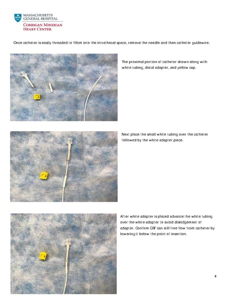 File:Spinal Drain Step by Step Guide Dalia.pdf