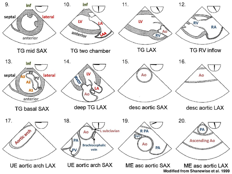 File:TEE-20views.pdf