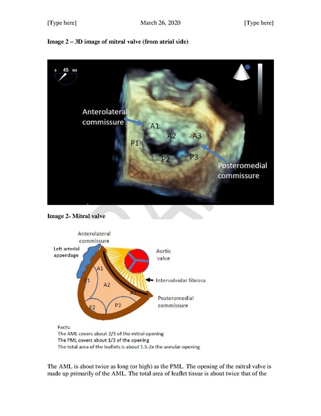 File:TEE Assessment of Mitral Regurgitation and Stenosis (March 26, 2020).pdf