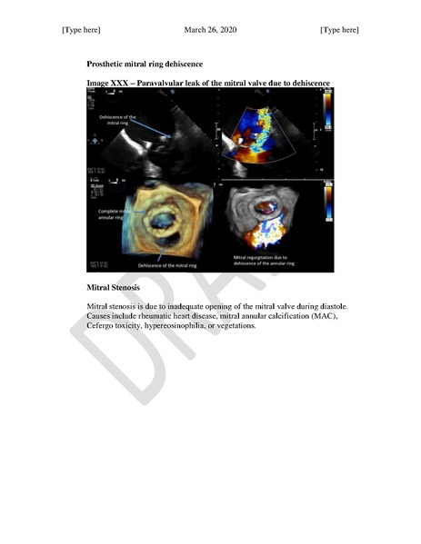 File:TEE Assessment of Mitral Regurgitation and Stenosis (March 26, 2020).pdf