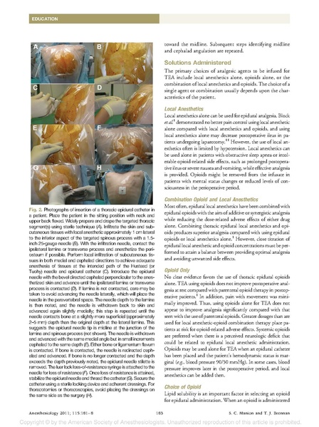 File:Thoracic epidural review (Manion 2011).pdf